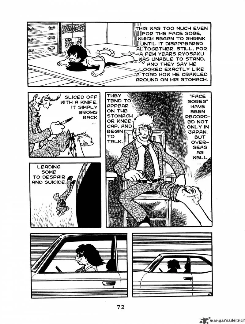 Black Jack Chapter 1 page 74