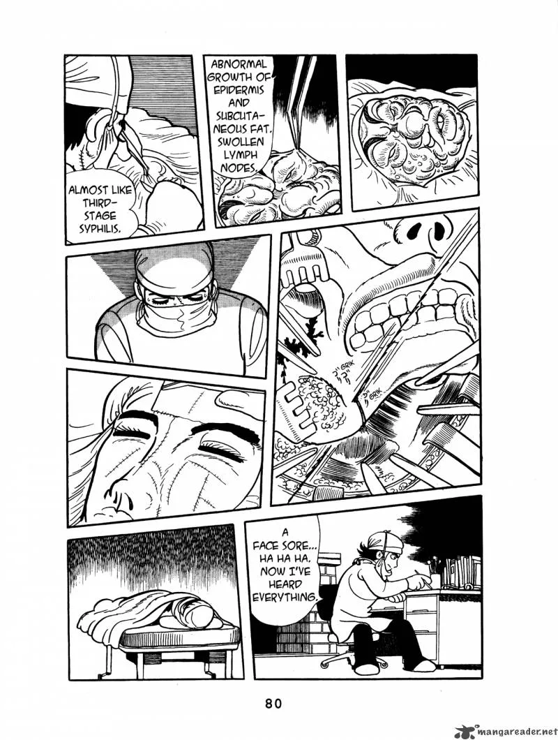 Black Jack Chapter 1 page 82