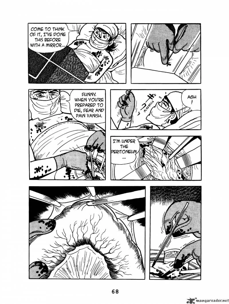 Black Jack Chapter 3 page 70